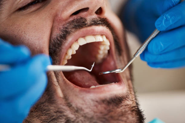 Best Pediatric Emergency Dentist in Tawas City, MI